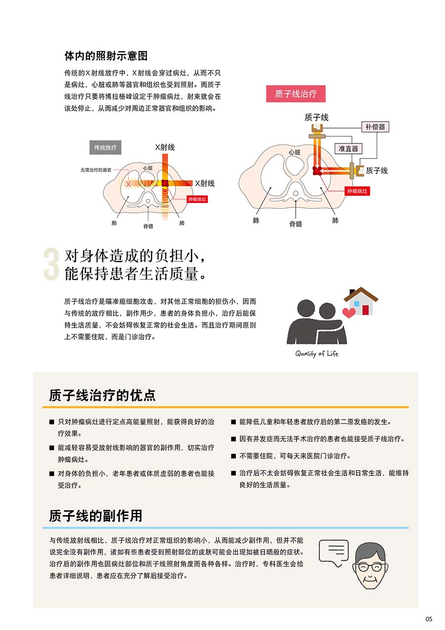 质子线治疗的优点